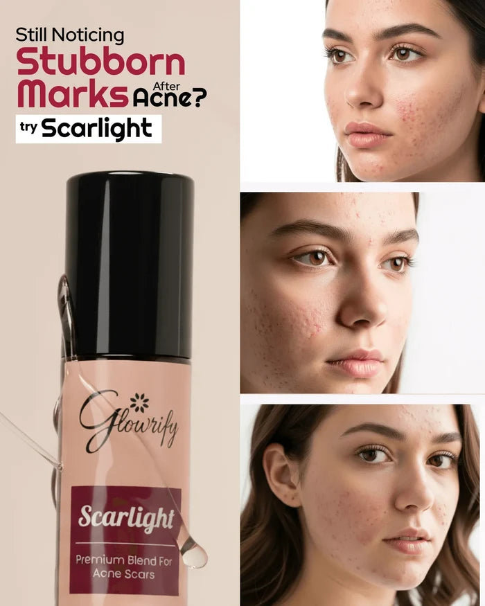 Scarlight 10ml | Herbal Skin Care Blend