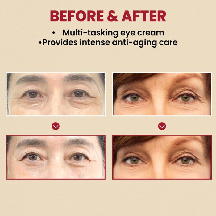 SEOUL 1988 Eye Cream - Retinal Liposome 4% + Fermented Bean 30ml - Beauty Tribe